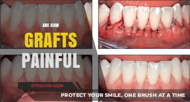 Are Gum Grafts Painful? What to Expect During Recovery
