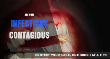 Can Gum Infections Spread? Understanding Contagious Risks and Prevention