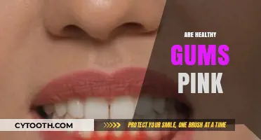 Are Healthy Gums Pink? Uncovering the Truth About Gum Color