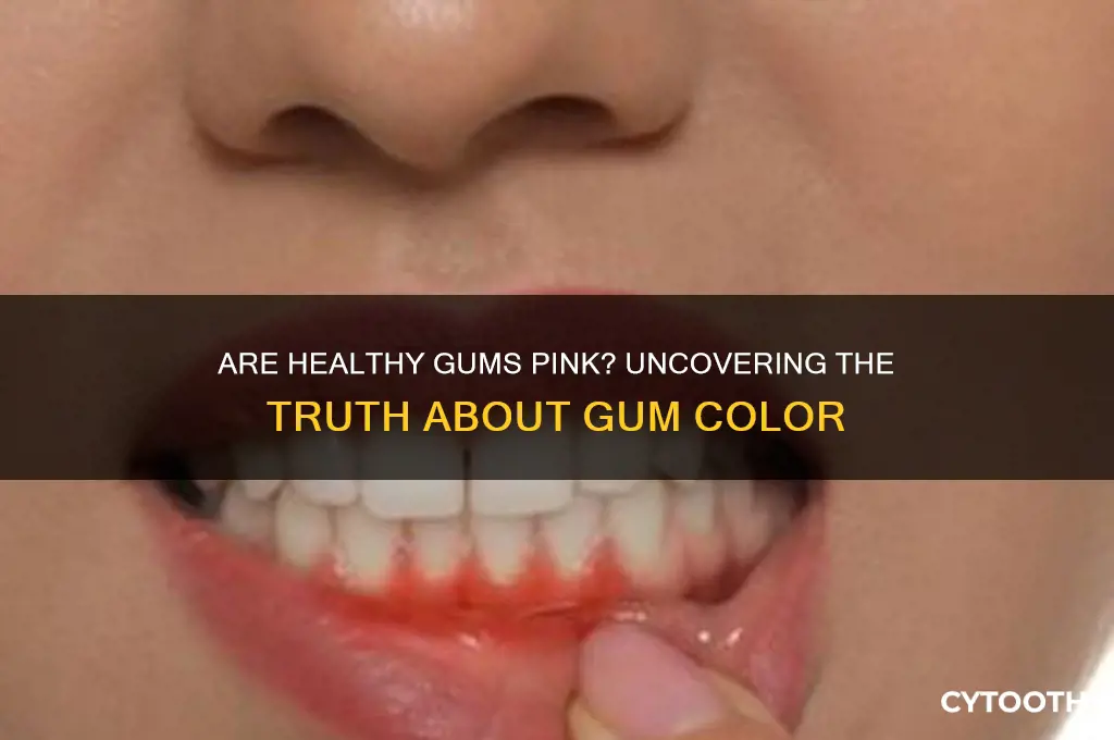 are healthy gums pink