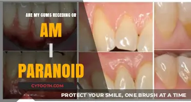 Receding Gums or Paranoia: Unraveling the Truth Behind Your Dental Concerns