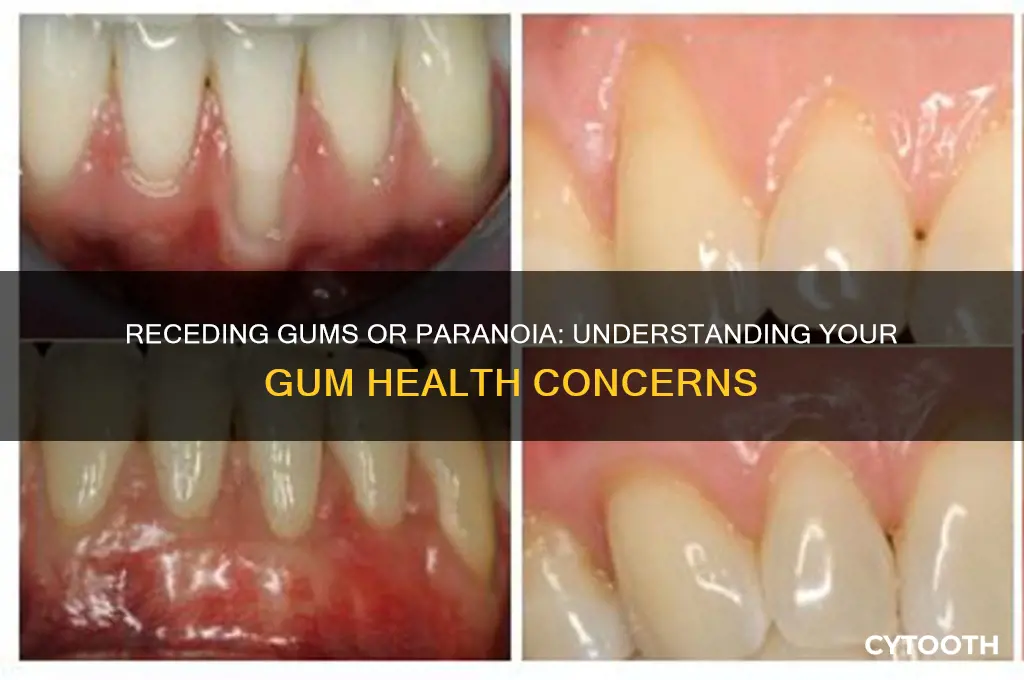 are my gums receding or am i paranoid