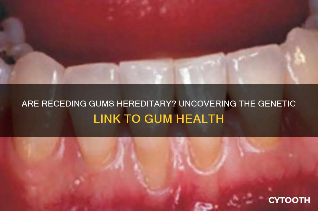 are receding gums hereditary