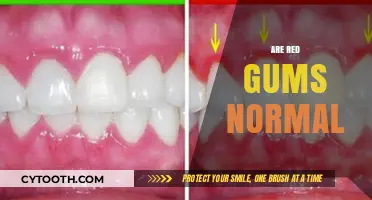 Are Red Gums Normal? Understanding Gum Health and When to Worry