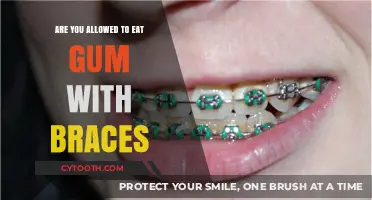 Can You Chew Gum with Braces? Orthodontic Tips and Advice
