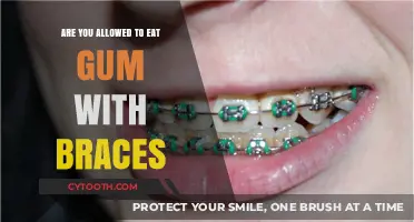 Can You Chew Gum with Braces? Orthodontic Tips and Advice