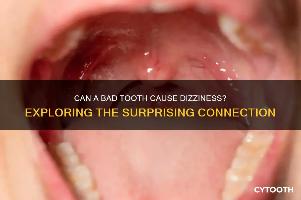 can a bad tooth make you dizzy
