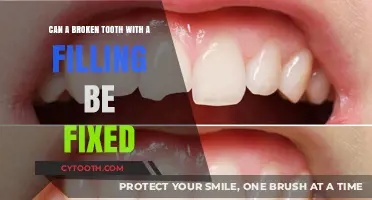 Can a Broken Tooth with a Filling Be Fixed? Expert Insights