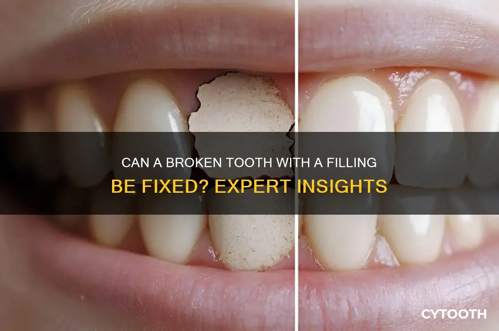 can a broken tooth with a filling be fixed
