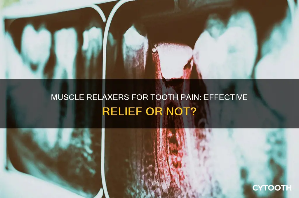 can a muscle relaxer help with tooth pain