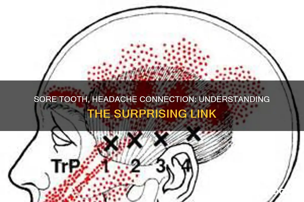 can a sore tooth give you a headache