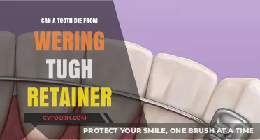 Can Retainers Cause Tooth Death? Understanding the Risks of Tight Wear