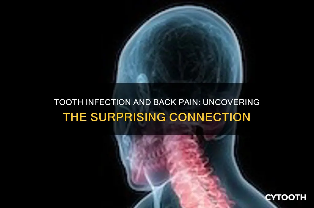 can a tooth infection cause back pain