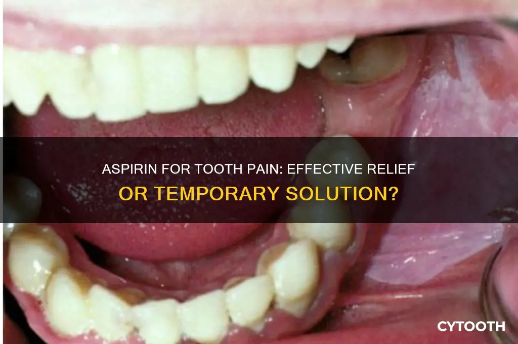 can aspirin help with tooth pain