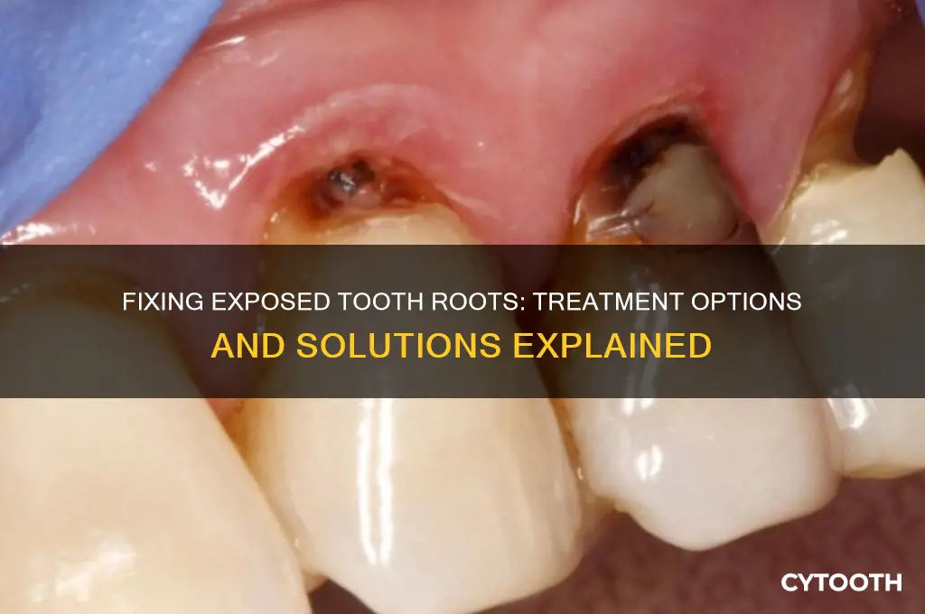 can exposed tooth roots be fixed