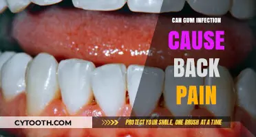 Gum Infections and Back Pain: Surprising Connection Explained