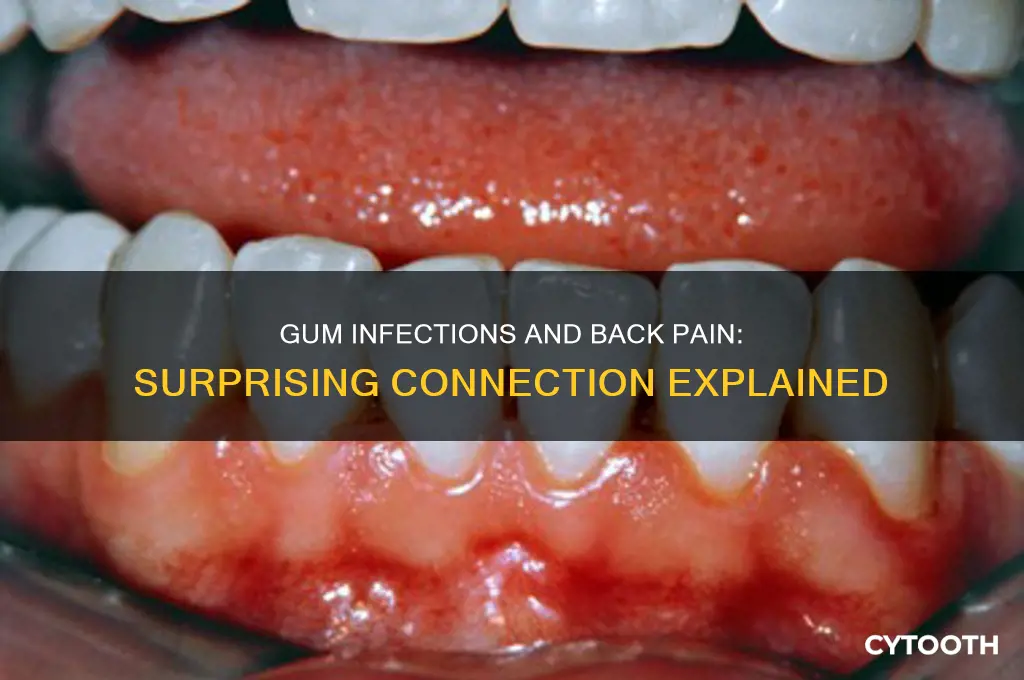 can gum infection cause back pain