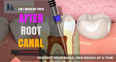 Brushing After a Root Canal: What You Need to Know