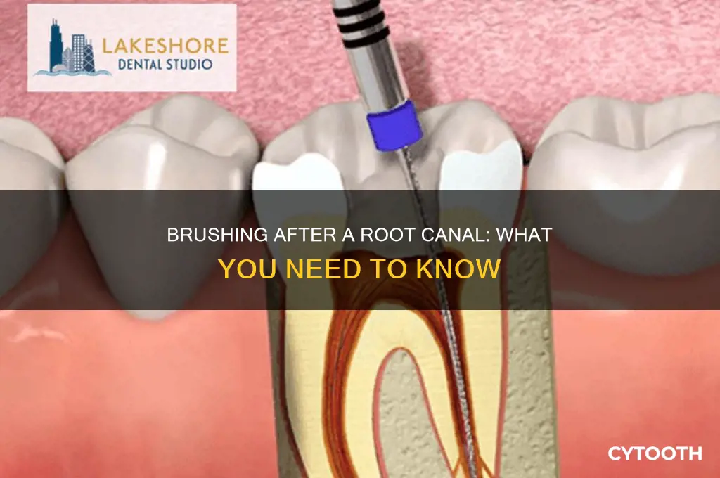 can i brush my tooth after root canal