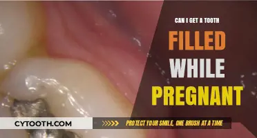 Pregnancy and Dental Care: Is It Safe to Get a Tooth Filled?
