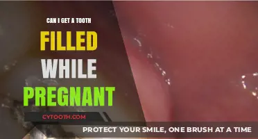 Pregnancy and Dental Care: Is It Safe to Fill a Tooth?