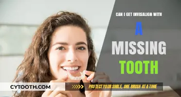 Invisalign with a Missing Tooth: Is It Possible? Find Out!