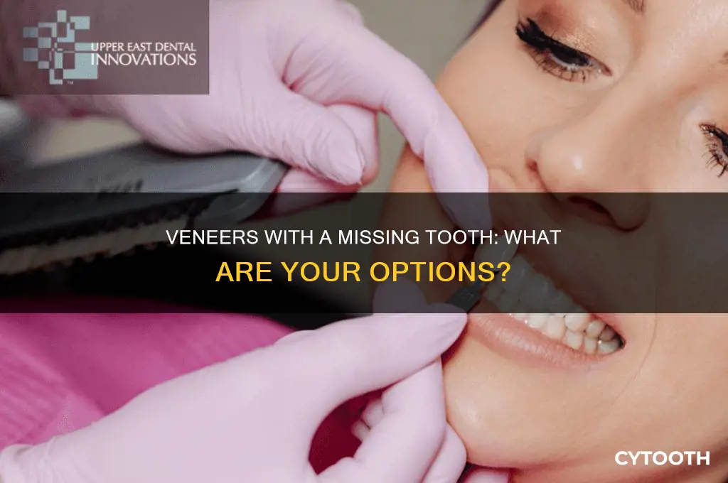 can i get veneers with a missing tooth