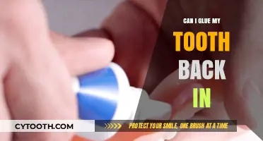 Can You Glue a Tooth Back In? Dental Emergency Tips