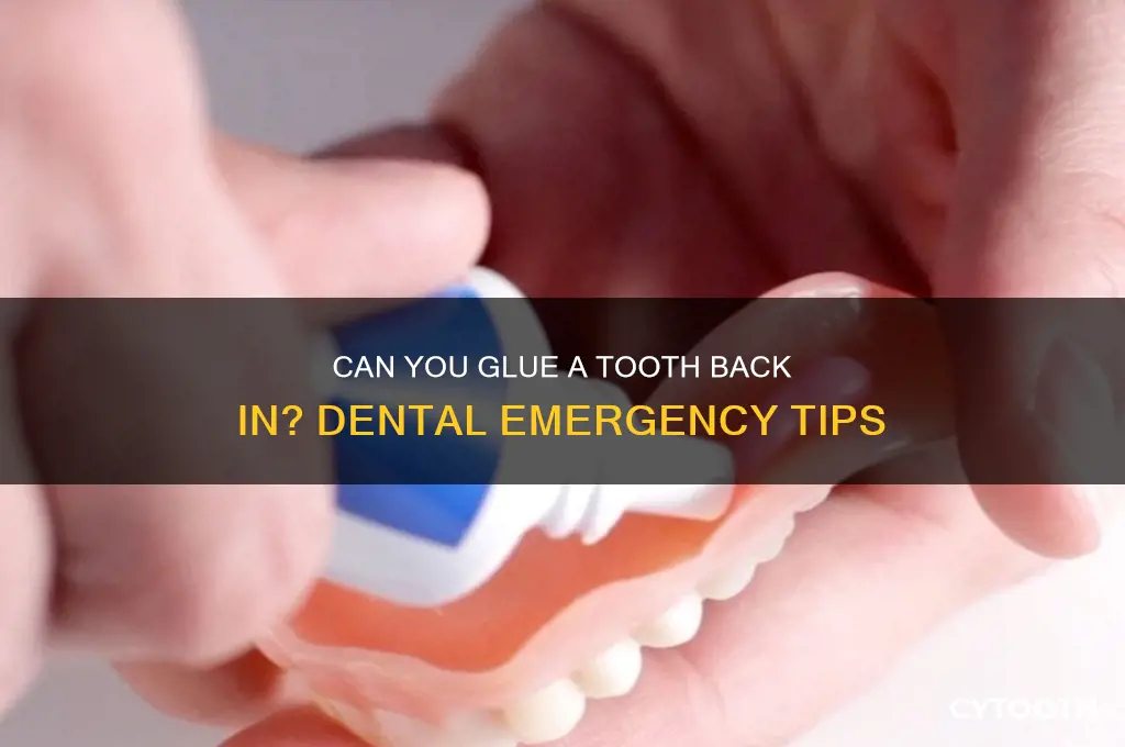 can i glue my tooth back in