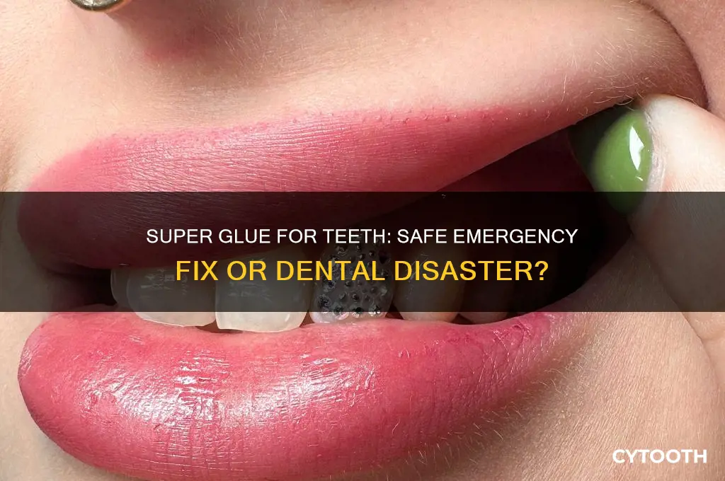 can i super glue my tooth