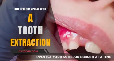 Post-Extraction Infections: Causes, Symptoms, and Prevention Tips Explained