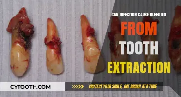 Can Infections Lead to Bleeding After Tooth Extraction? Find Out Here