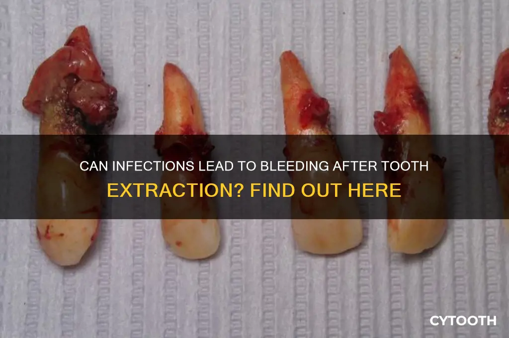 can infection cause bleeding from tooth extraction