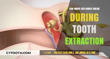 Can Inner Ear Bones Break During Tooth Extraction? Facts Revealed