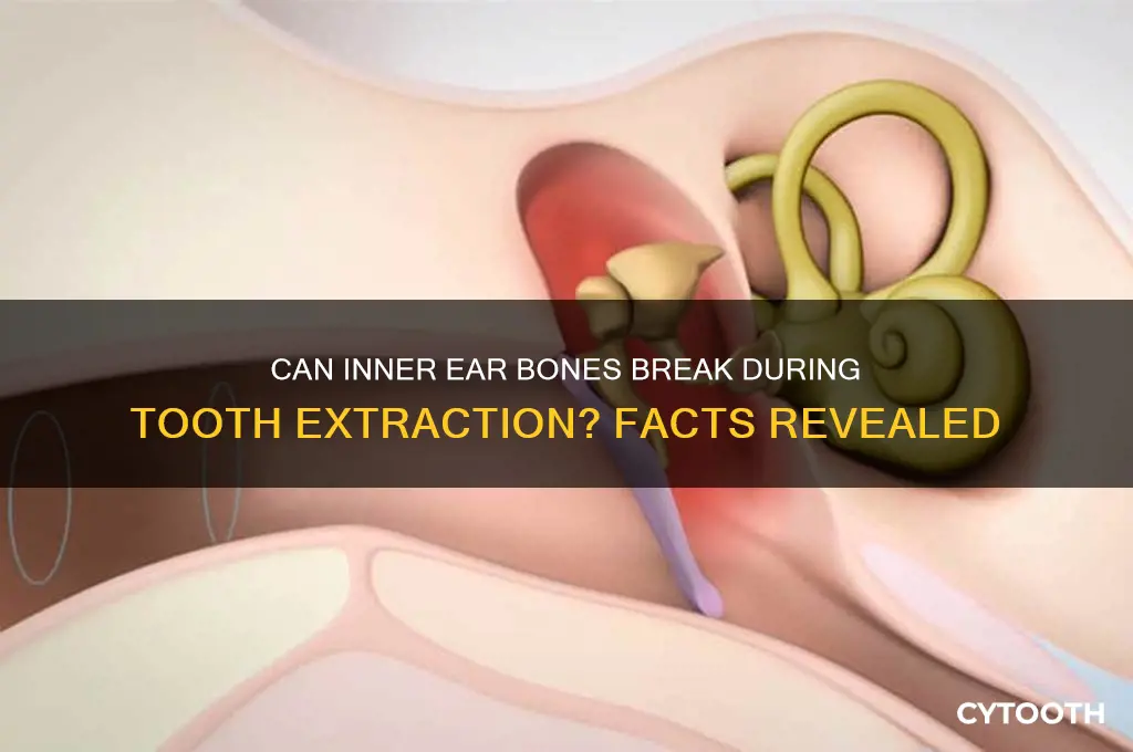 can inner ear bones break during tooth extraction