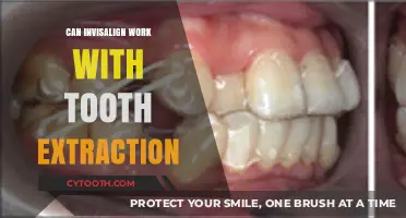 Invisalign and Tooth Extraction: Can They Work Together Effectively?