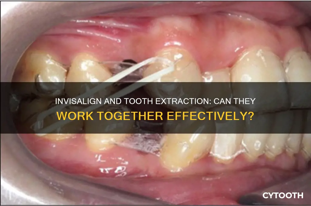 can invisalign work with tooth extraction