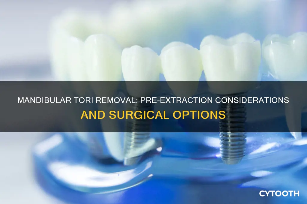 can mandibular tori be removed before tooth extraction