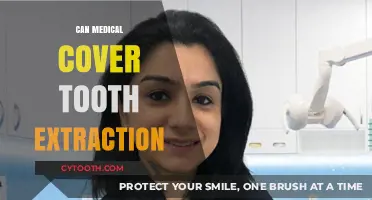 Does Medical Insurance Cover Tooth Extraction Costs? What You Need to Know