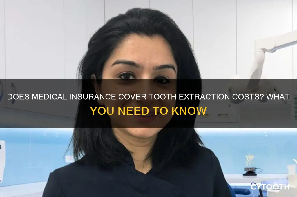 can medical cover tooth extraction