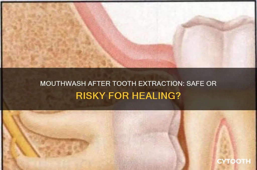 can mouthwash be used after tooth extraction
