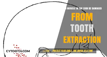 Can Chin Muscles Be Damaged During Tooth Extraction?