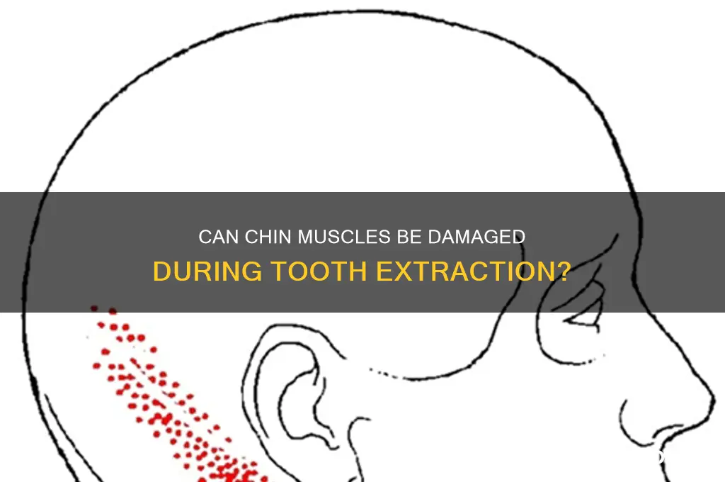 can muscle in the chin be damaged from tooth extraction