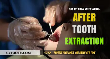 Child’s School Return Post-Tooth Extraction: What Parents Need to Know