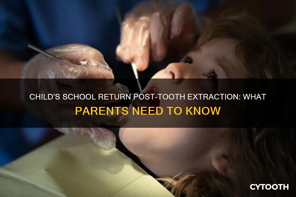 can my child go to school after tooth extraction