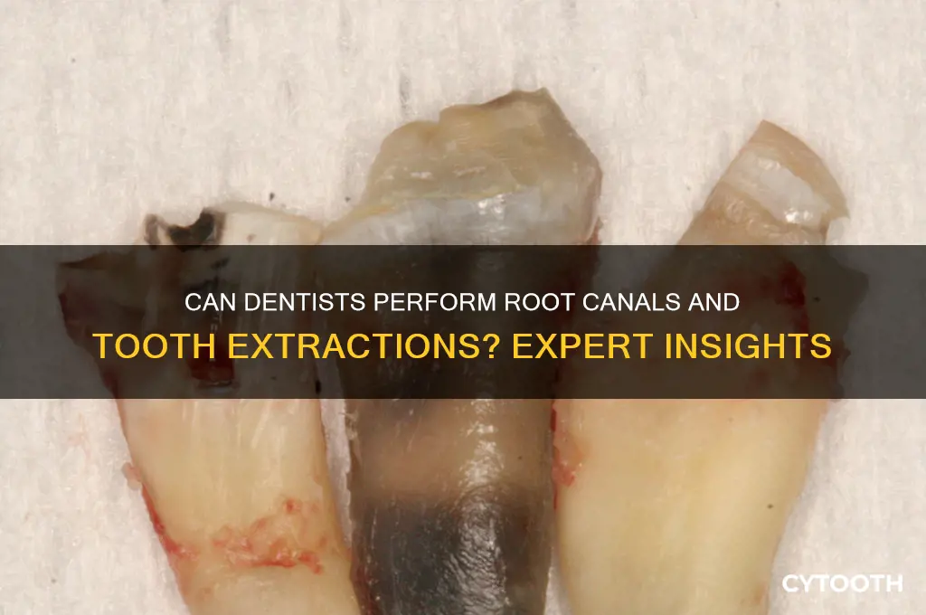 can my dentist do a root canal tooth extraction