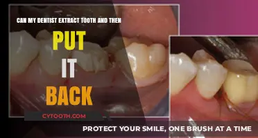 Can a Dentist Reinsert an Extracted Tooth? Exploring the Possibility