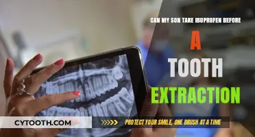 Is Ibuprofen Safe Before My Son's Tooth Extraction? Expert Advice