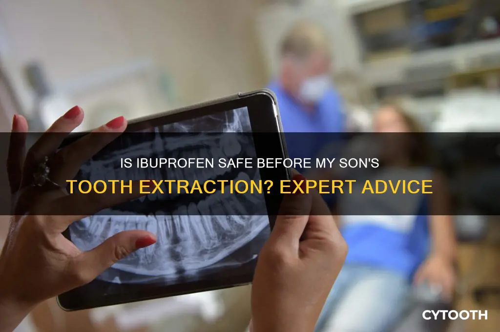 can my son take ibuprofen before a tooth extraction