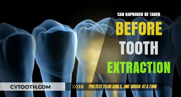 Is Naproxen Safe Before Tooth Extraction? Expert Advice and Tips